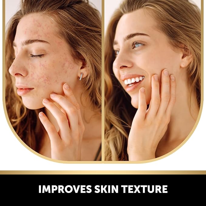 VALITIC Kojic Acid Soap for Hyperpigmentation - with Glutathione, Collagen & Vitamin C - Natural Soap Bars with Turmeric - Original Japanese Complex for Dark Spot Correction - 3 Pack