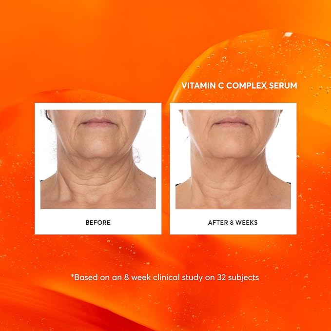 Naturium Vitamin C Complex Face Serum Jumbo, Anti-Aging Facial Treatment with Hyaluronic Acid & Vitamin E, 2 oz