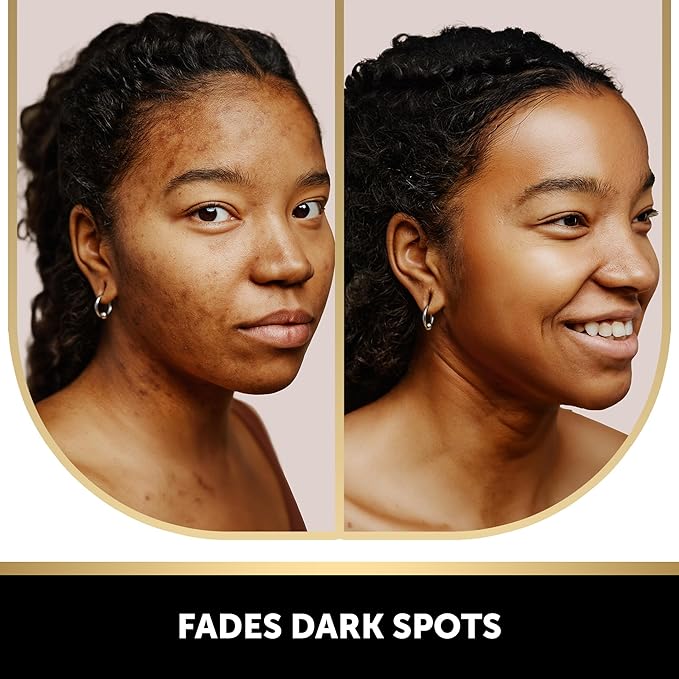 VALITIC Kojic Acid Soap for Hyperpigmentation - with Glutathione, Collagen & Vitamin C - Natural Soap Bars with Turmeric - Original Japanese Complex for Dark Spot Correction - 4 Pack + Holder